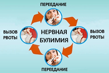 Лечение булимии в Чиколе